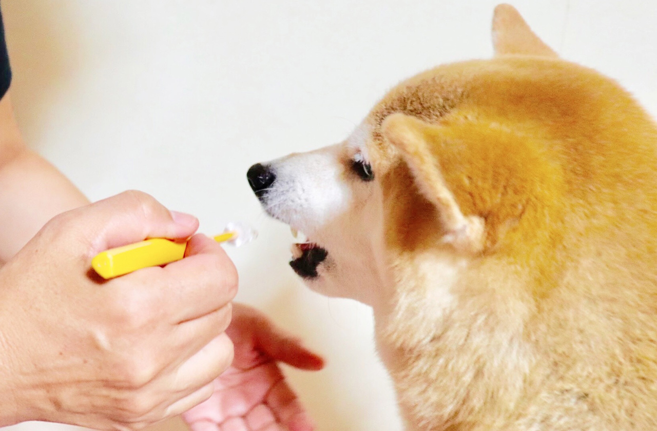 歯周病・歯石除去